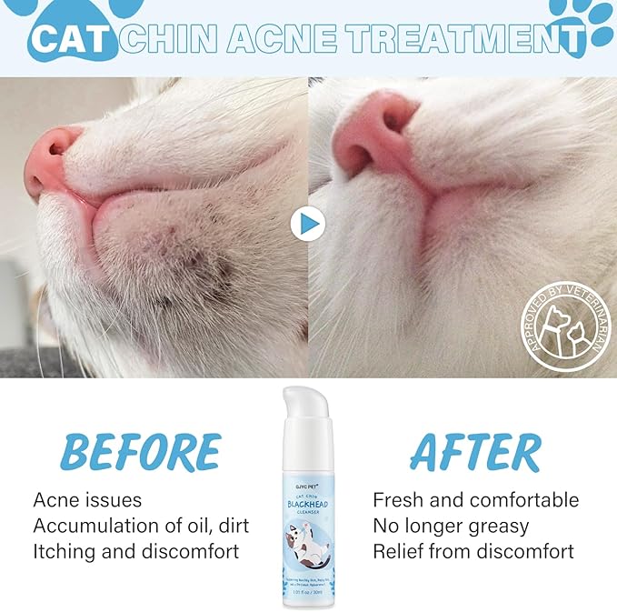 Cat Chin Acne Care Kit - Gently Removes Cat Chin Blackheads, Equipped with Cleansing Brush, Cruelty-Free, Nurtures Cat's Chin Softness and Freshness, 1.01 fl. oz